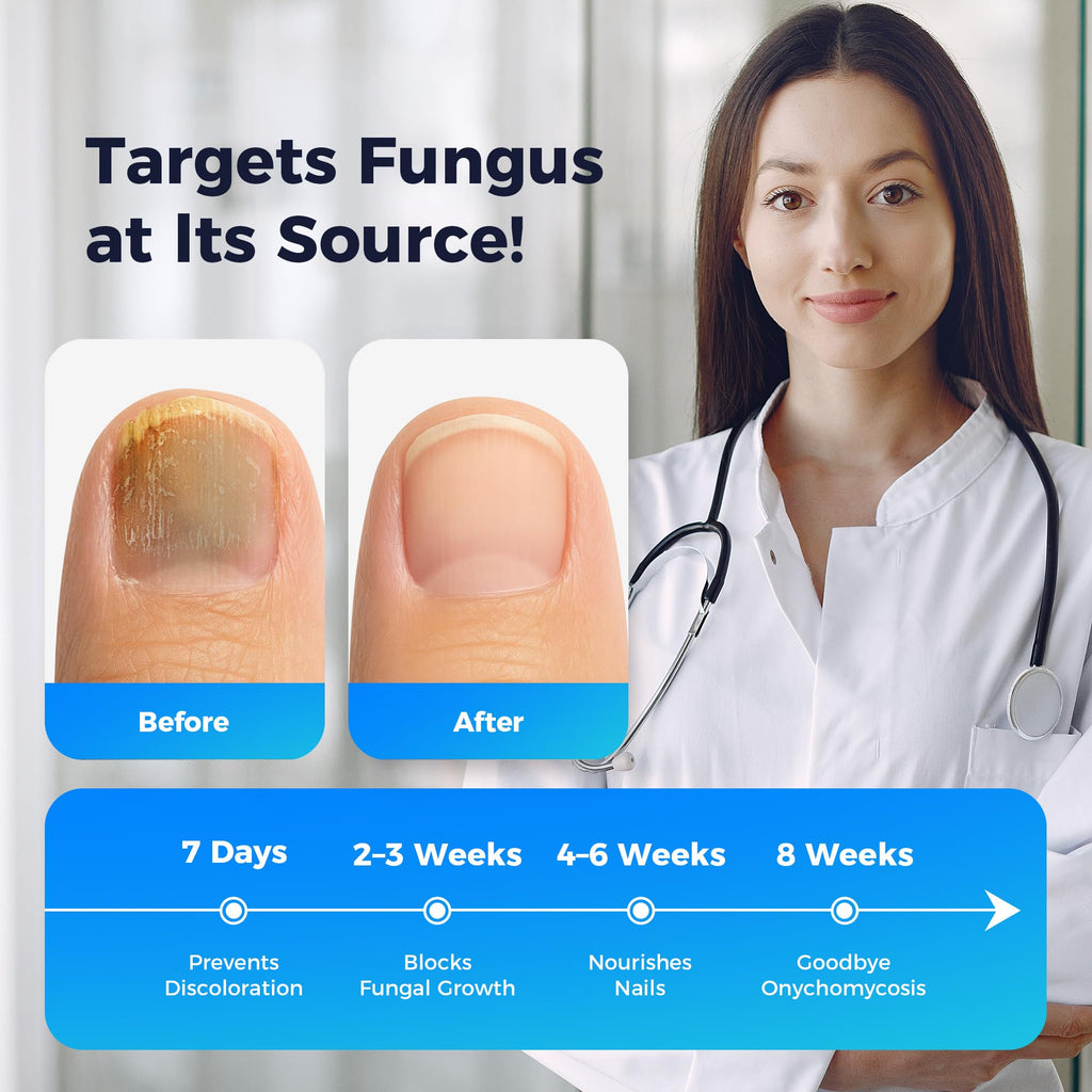 Rinlus Fungal Nail Patches & Nail Repair Pen – Fast-Acting 7-Day Toenail Treatment