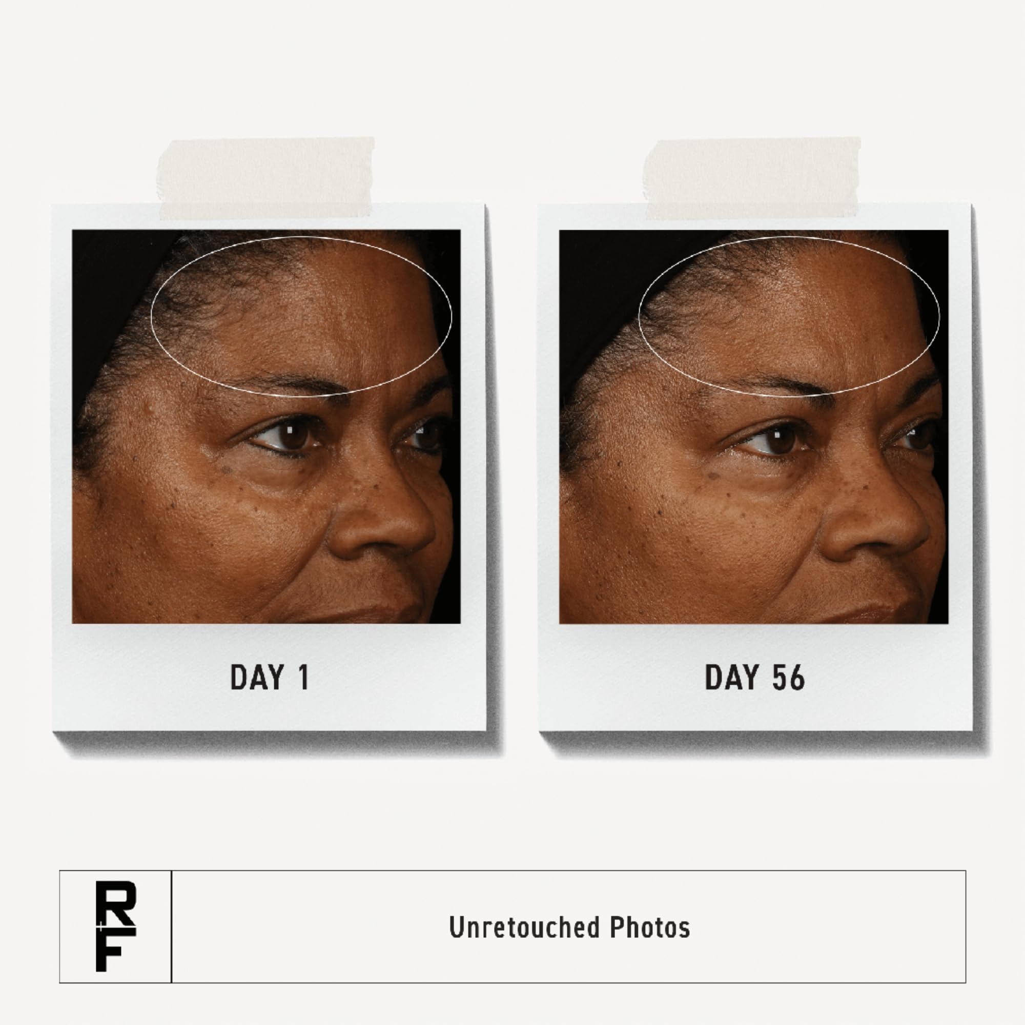 RODAN + FIELDS Redefine Overnight Restorative Cream – Step 3 PM Night Moisturizer with Glycolic Acid & Bakuchiol