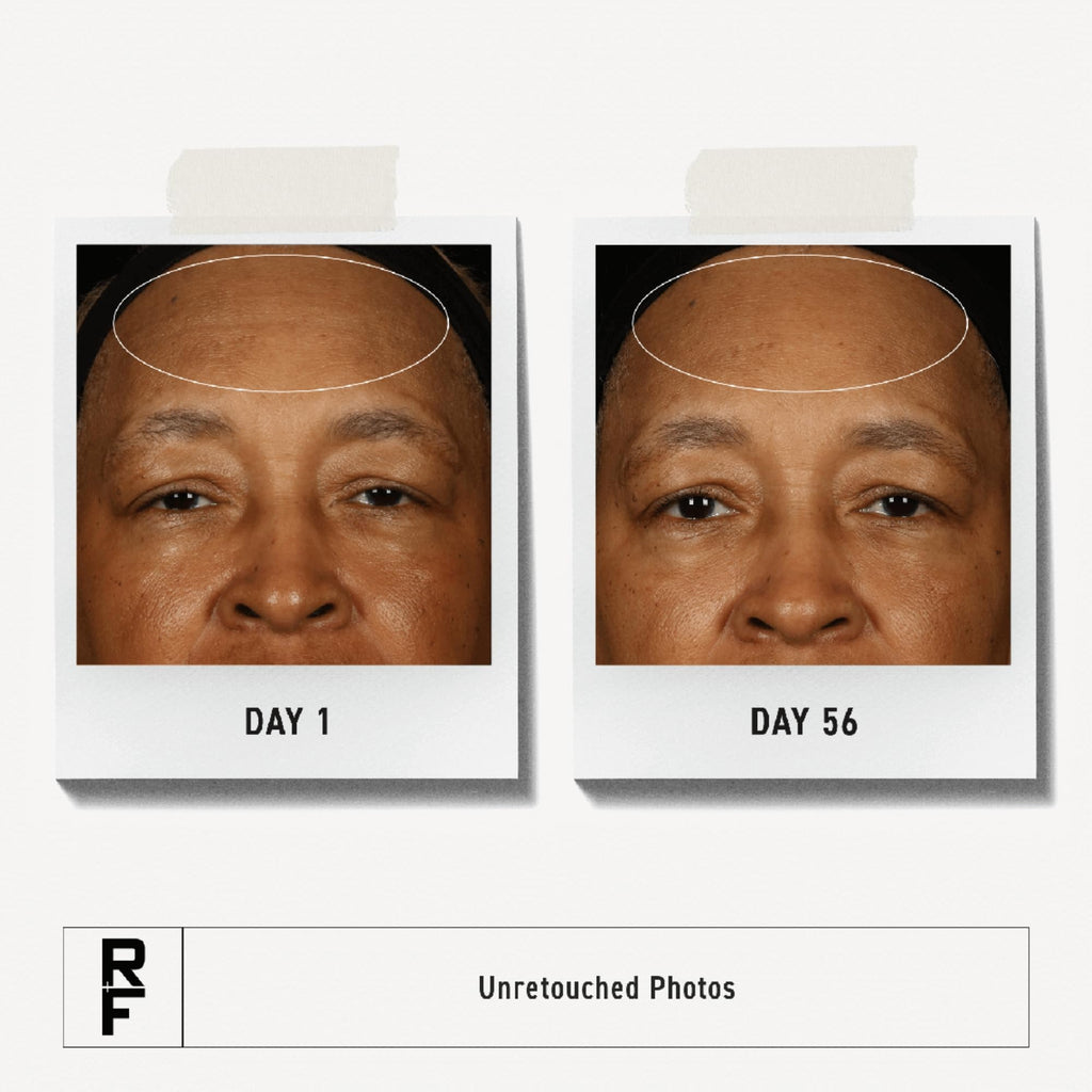 RODAN + FIELDS Redefine Overnight Restorative Cream – Step 3 PM Night Moisturizer with Glycolic Acid & Bakuchiol