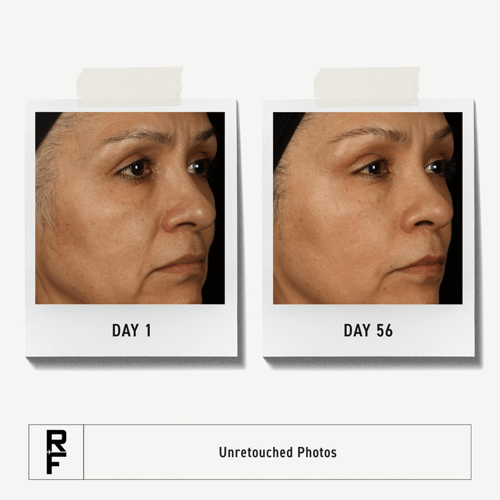 RODAN + FIELDS Total RF Serum 30 mL | Hydration & Fine Line Targeting for Women