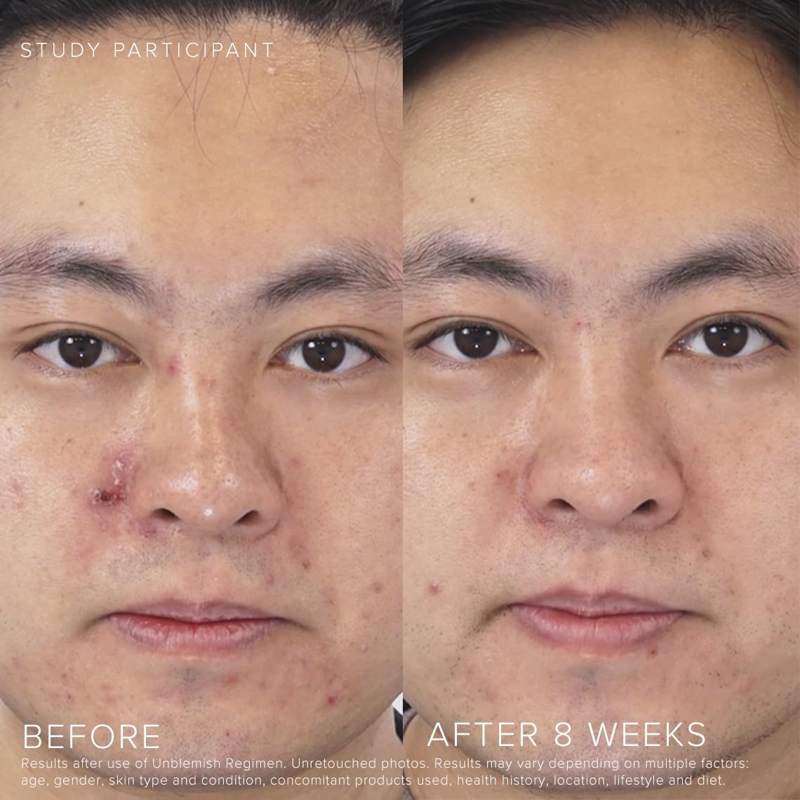 Rodan + Fields UNBLEMISH Invisible Matte Defense SPF 30 — Oil-Free Moisturizer with Sunscreen for Face & Neck