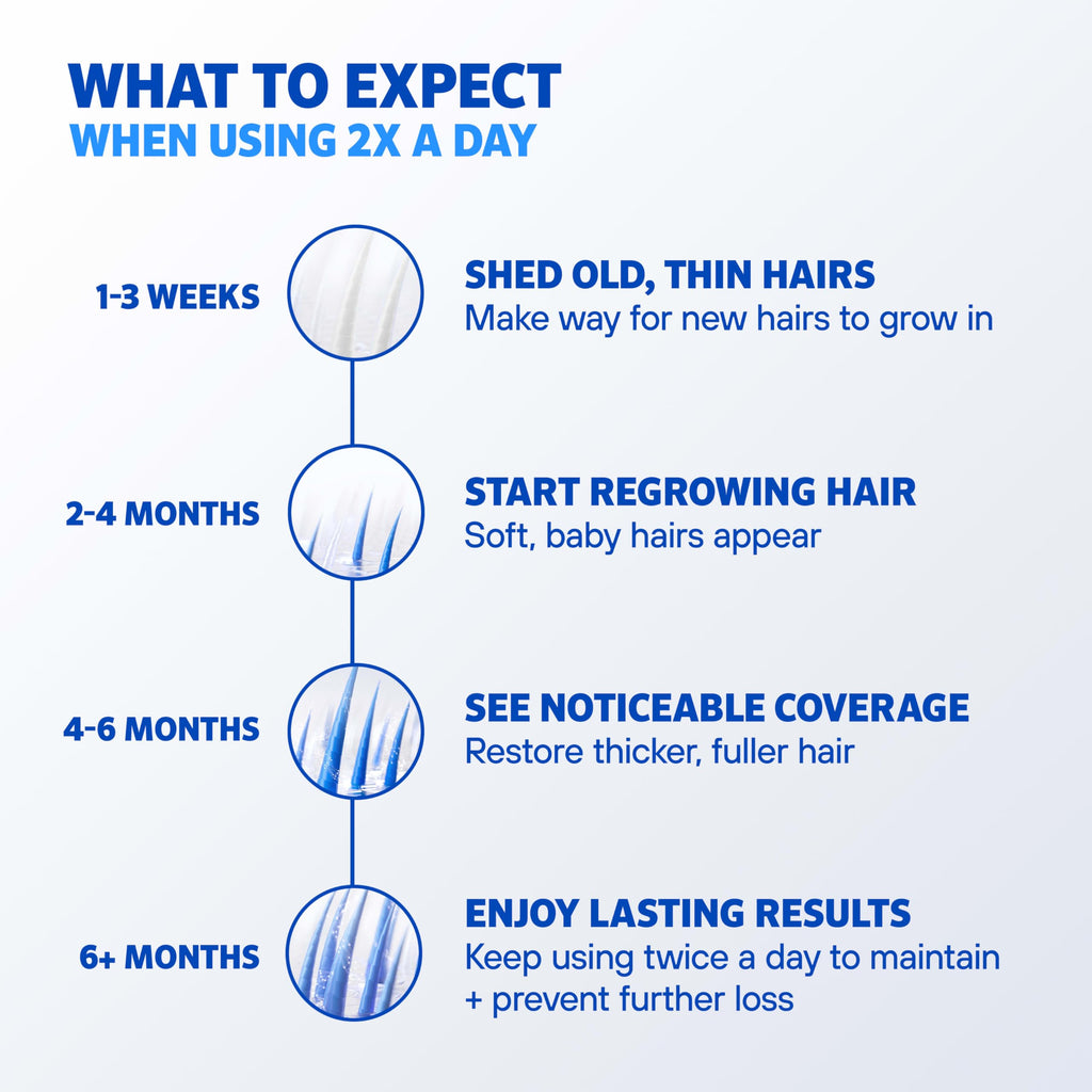 Rogaine Men’s 5% Minoxidil Foam for Hair Regrowth – Unscented, 3-Month Supply