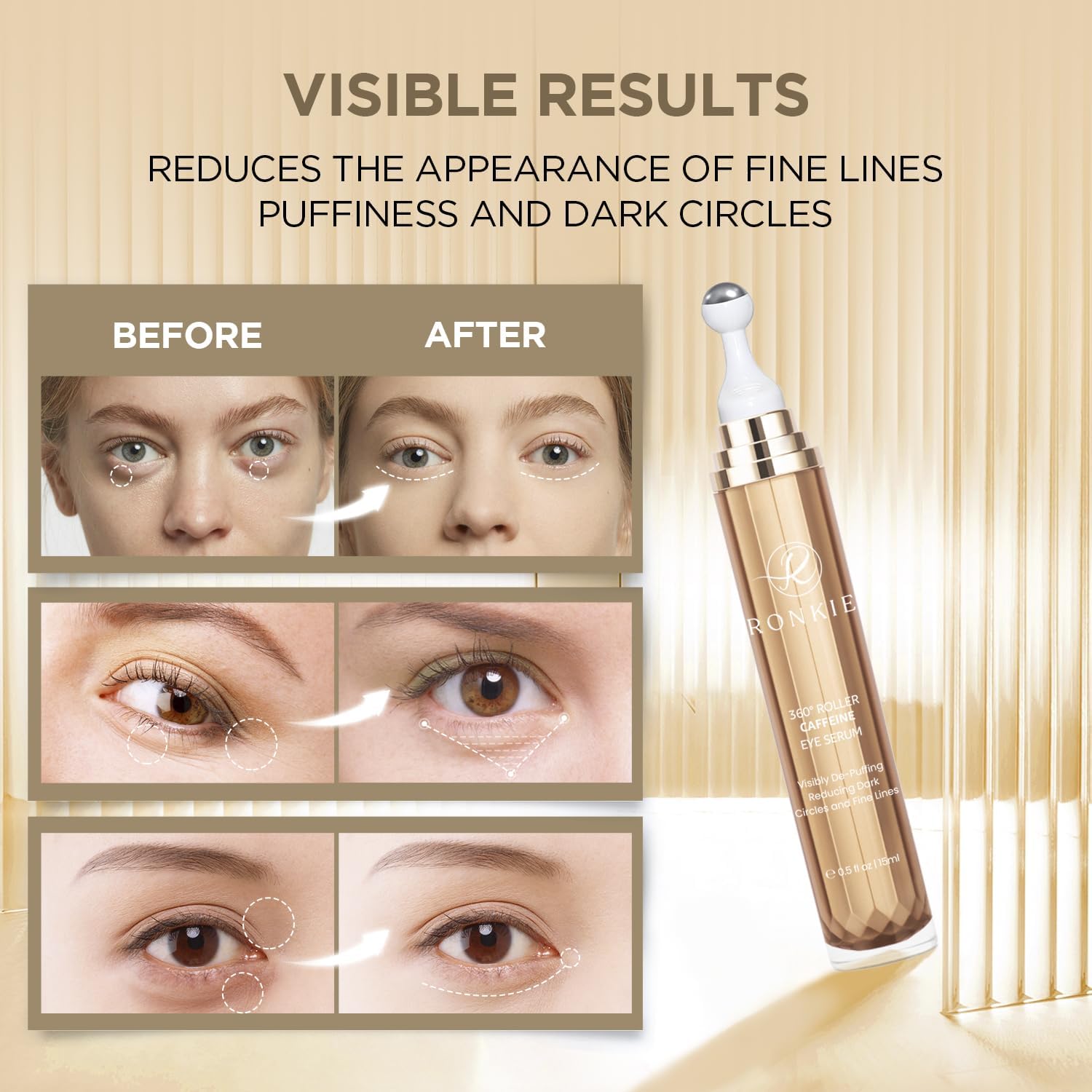 RONKIE Eye Cream for Dark Circles: Caffeine + Retinol for Brighter Eyes – Reduces Puffiness & Fine Lines (Gold)