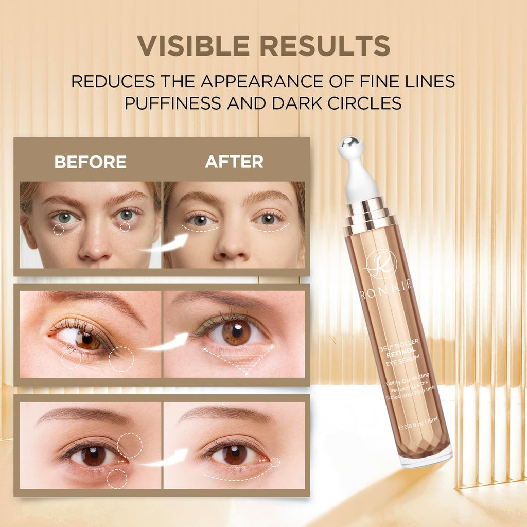 RONKIE Eye Cream for Dark Circles – Caffeine, Retinol & Hyaluronic Acid Stick