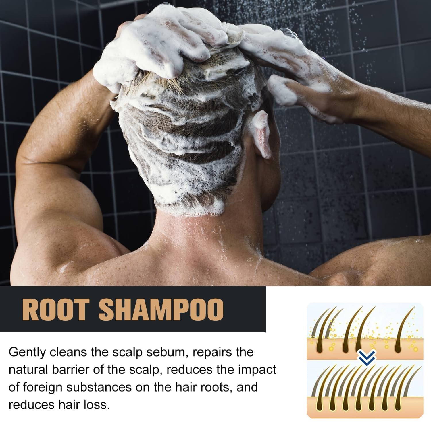 2 Pcs Root Activator Shampoo – Hair Growth Root Activator Shampoo for Anti-Hair Loss | Natural Formula for Men & Women