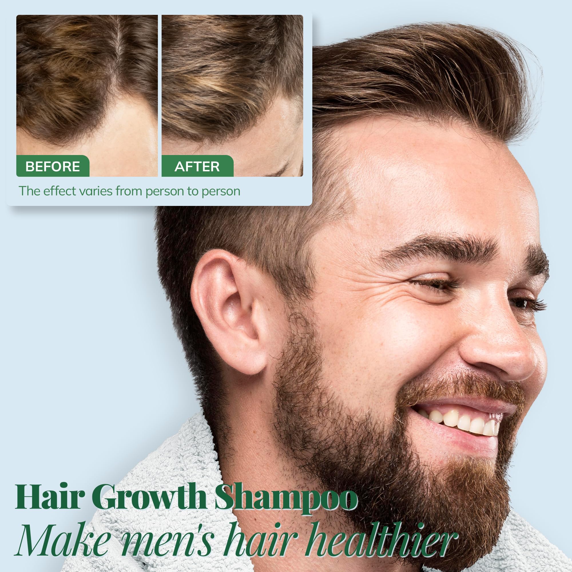 RootStim Hair Growth Shampoo – Rosemary, Caffeine & Biotin for Stronger Roots