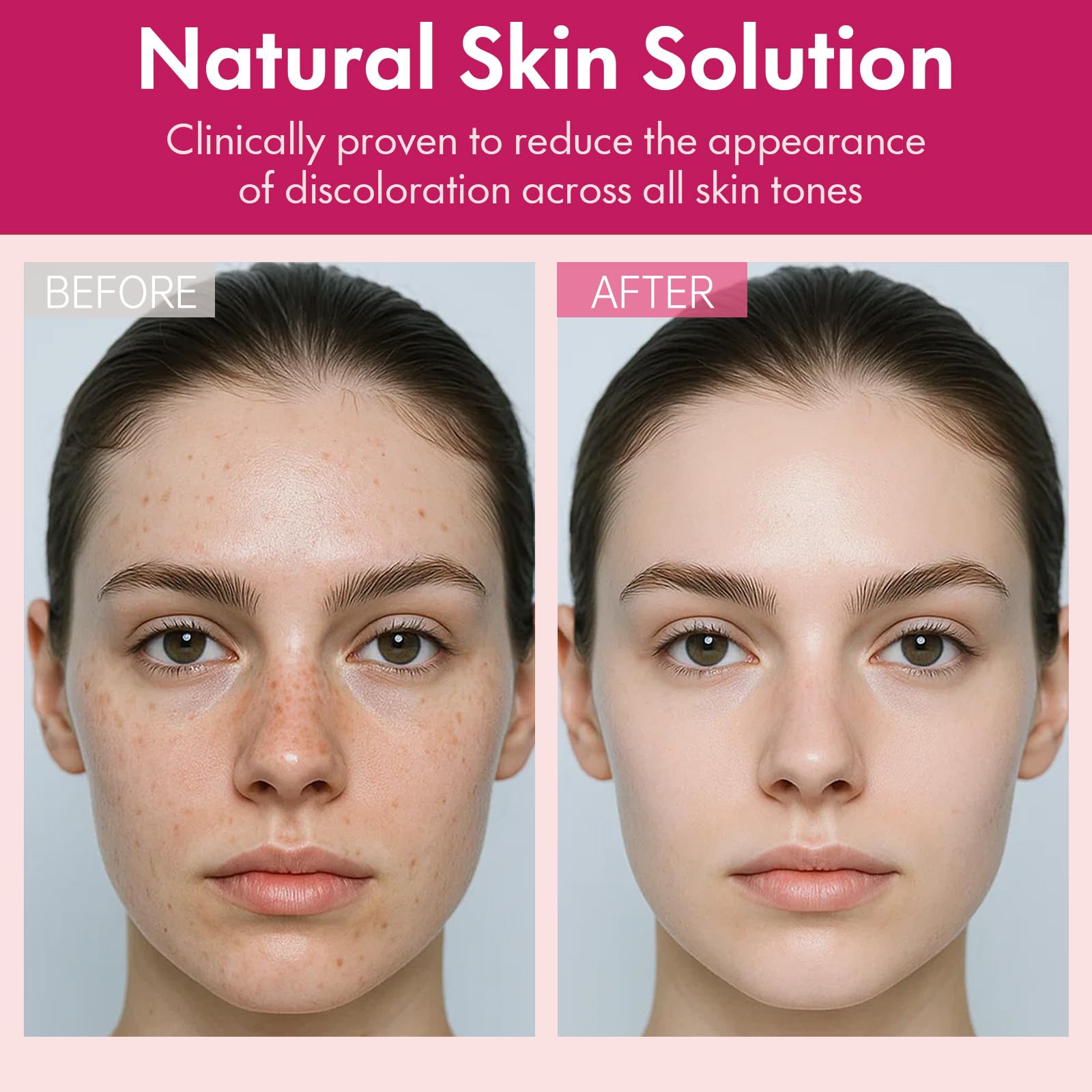 Roseblem Arbutin 7% + Tranexamic 4% Face Cream for Dark Spots & Even Tone – Hydrating & Gentle