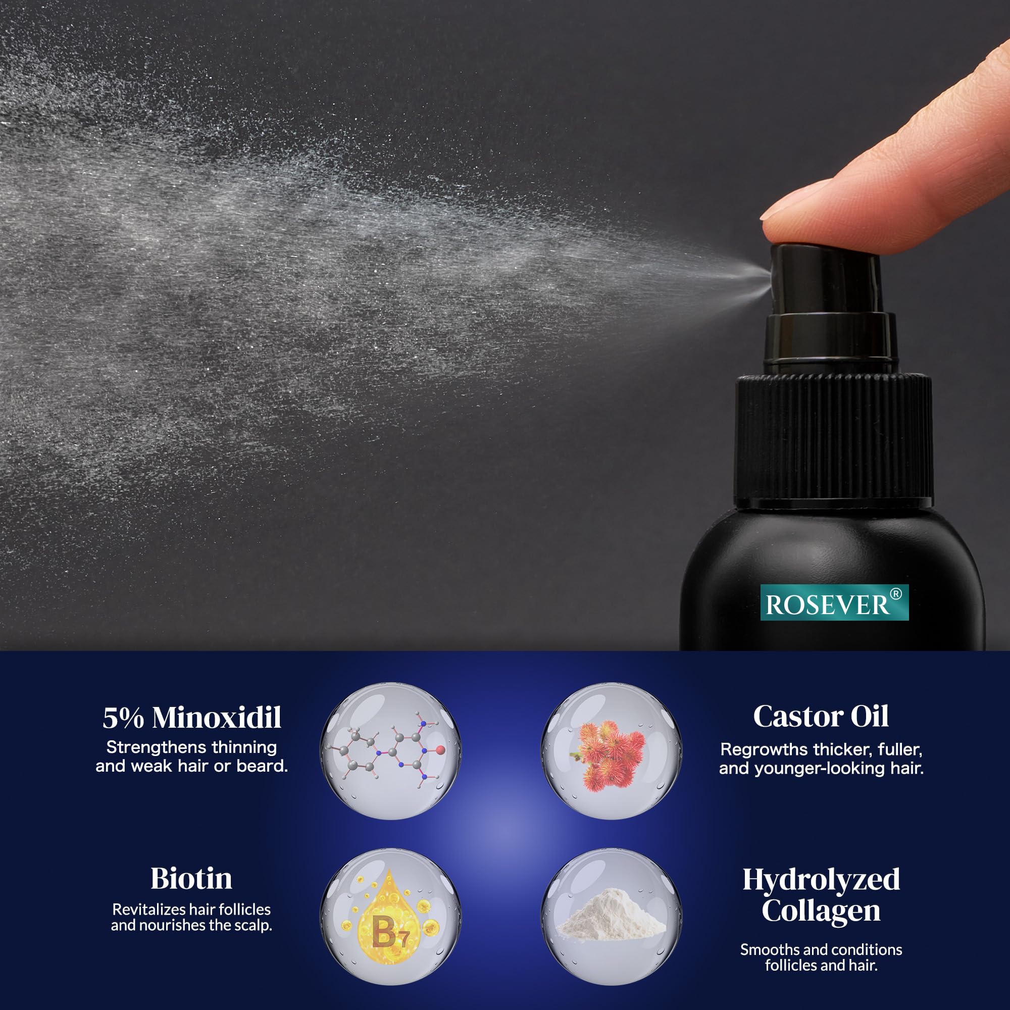 Rosever 5% Minoxidil Spray for Hair & Beard Growth – Men & Women, 2-Pack