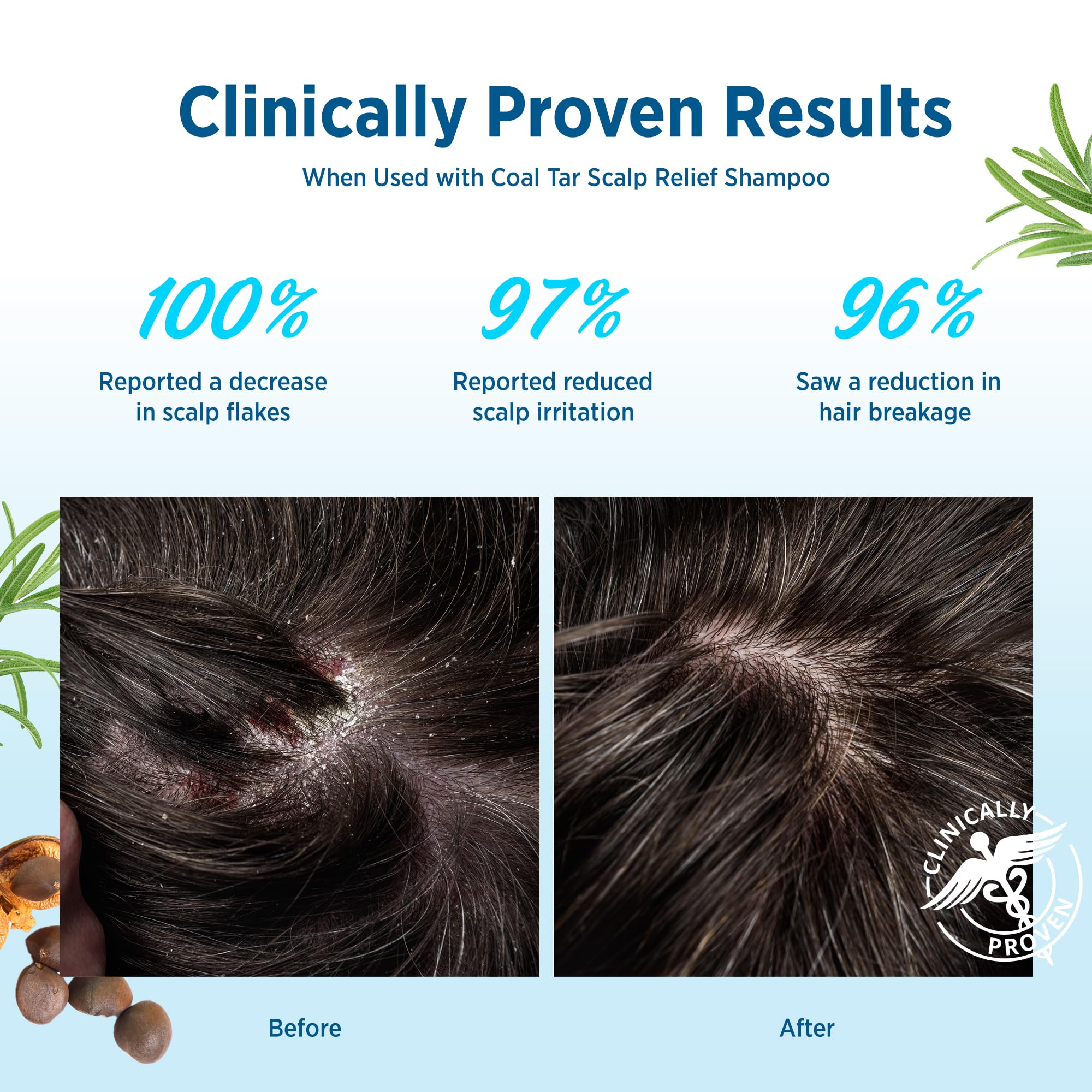 Roycederm Scalp Relief & Moisture Conditioner | Hydrating Jojoba, Aloe Vera & Camellia Oil