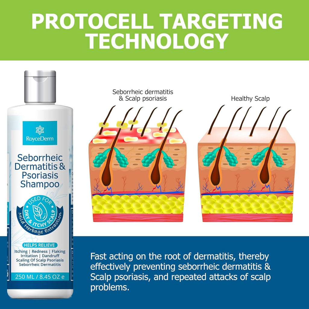 Roycederm Psoriasis & Seborrheic Dermatitis Shampoo – Itch Relief & Flake Control