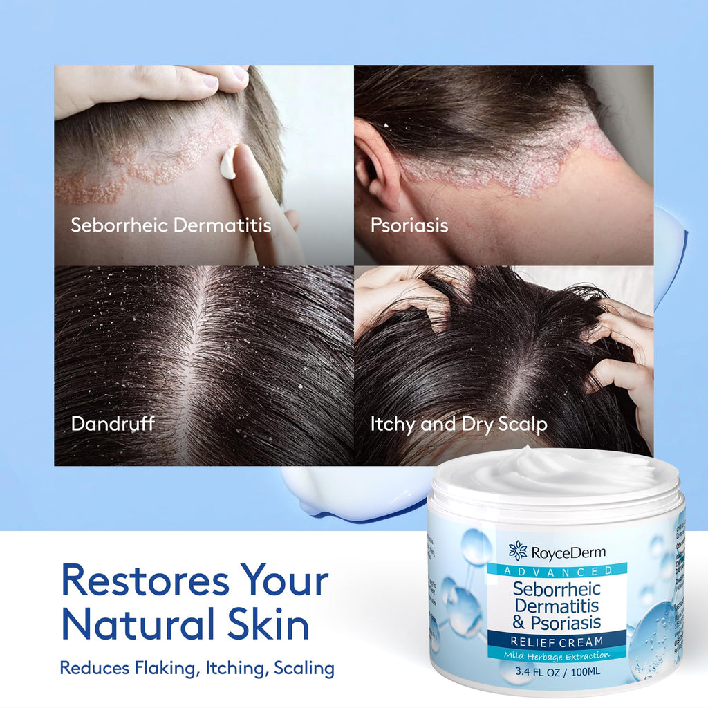 Roycederm Seborrheic Dermatitis & Psoriasis Scalp Treatment Kit – Shampoo and Cream for Dry Itchy Scalp