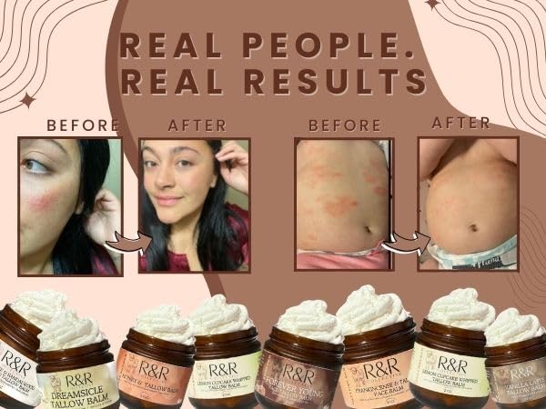 R&R Collective Forever Young Tallow Face Moisturizer – 2 oz, 100% Grass-Fed Whipped Balm with Blue Cypress