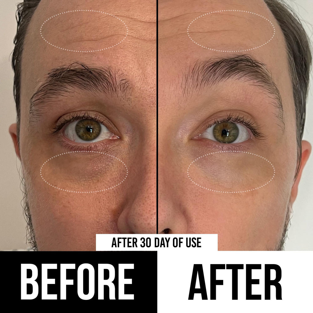 RUGGED & DAPPER Premium Men's Eye Cream | Age Defense for Dark Circles, Wrinkles & Puffy Eyes | Unscented | Hyaluronic Acid, Aloe + Argan Oil