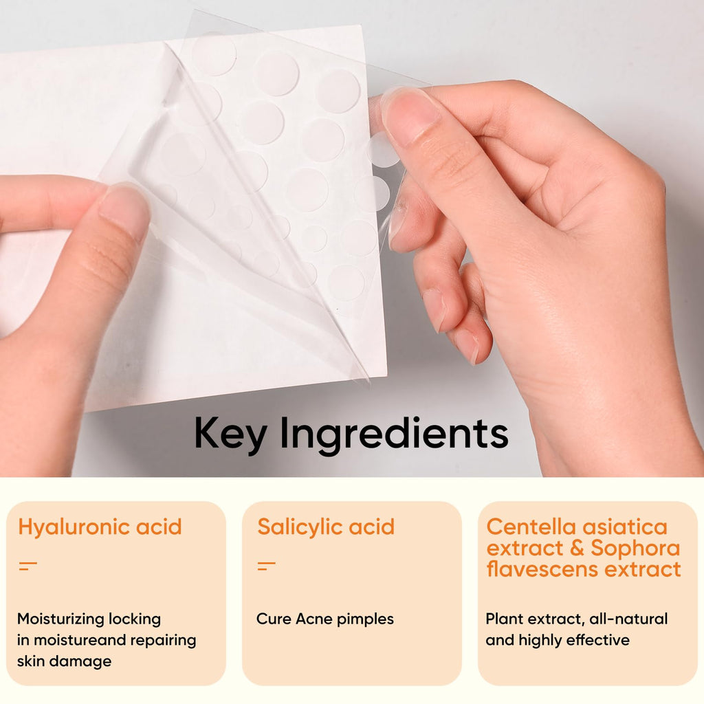 Rulvcian Microdart Acne Patches & Salicylic Acid Pimple Patches | Fast Zit Care