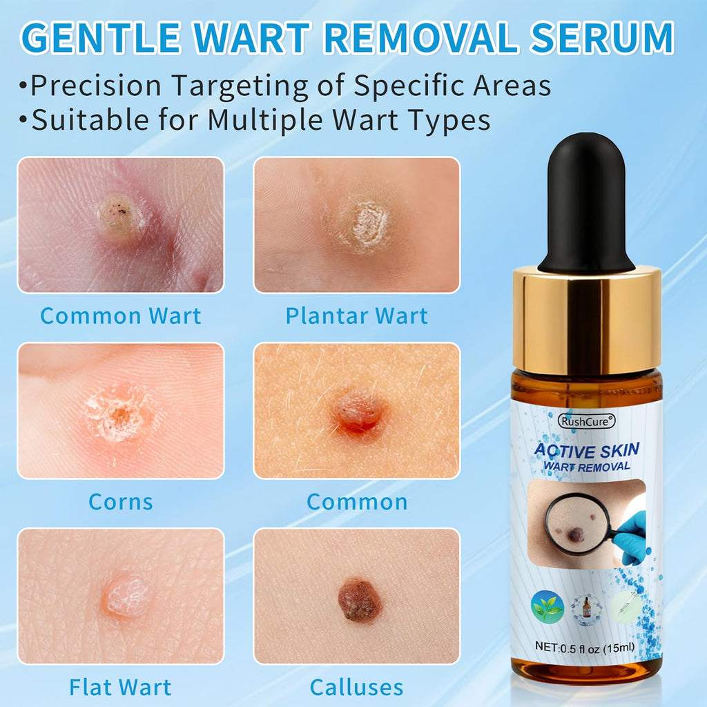 RushCure Wart Remover Serum — 17% Salicylic, Precision Dropper, Travel Size 0.5 oz