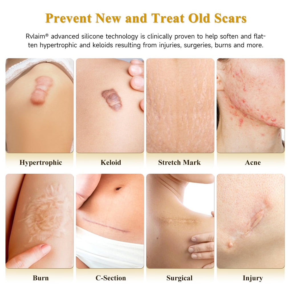 Rvlaim Scar Cream Silicone Gel | Advanced Scar Repair for Surgical, Burn, Acne Scars 1.85 oz