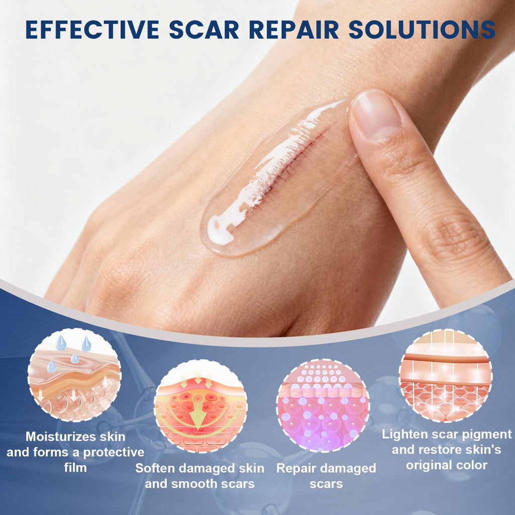 Rvlaim 100% Silicone Scar Gel – Advanced Scar Care, 1.7 oz (50 ml)