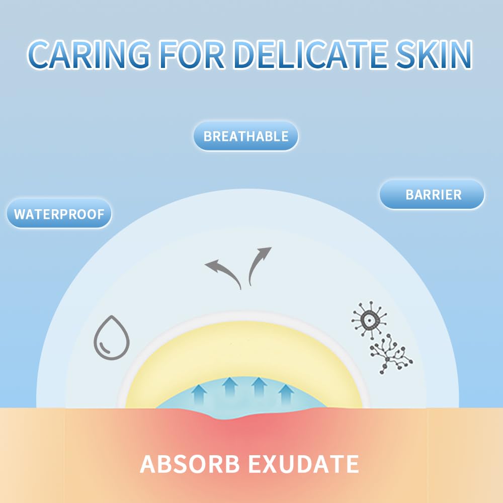Safirst Star Acne Patches – Hydrocolloid Pimple Patches, 3 Sizes, 200 Count