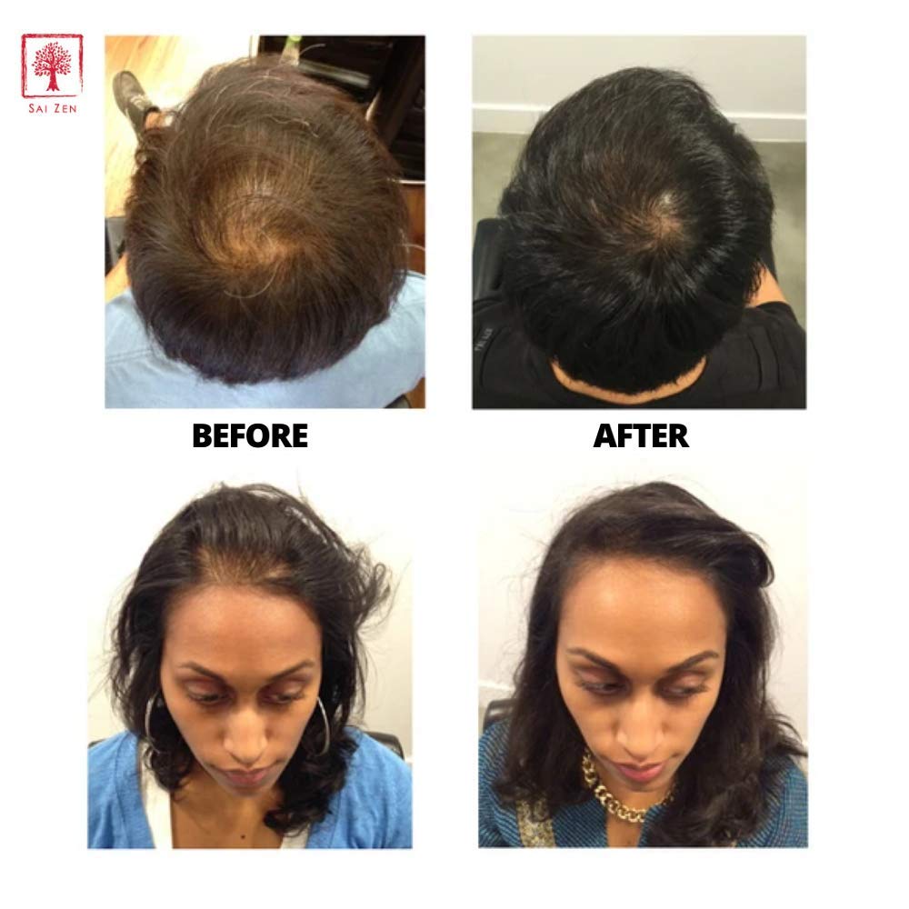 Sai Zen Volume Plus Shampoo | Anti-Thinning & Volumizing Formula | Made in USA | 8 oz | Sulfate & Paraben Free