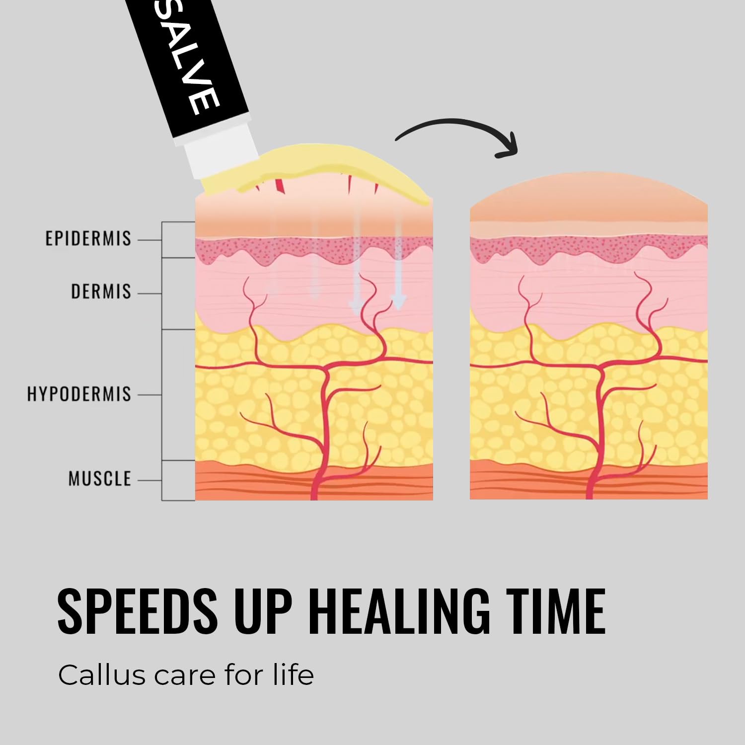 SandBar Natural Callus Salve – Revitalizing Balm for Calluses | On-The-Go Care