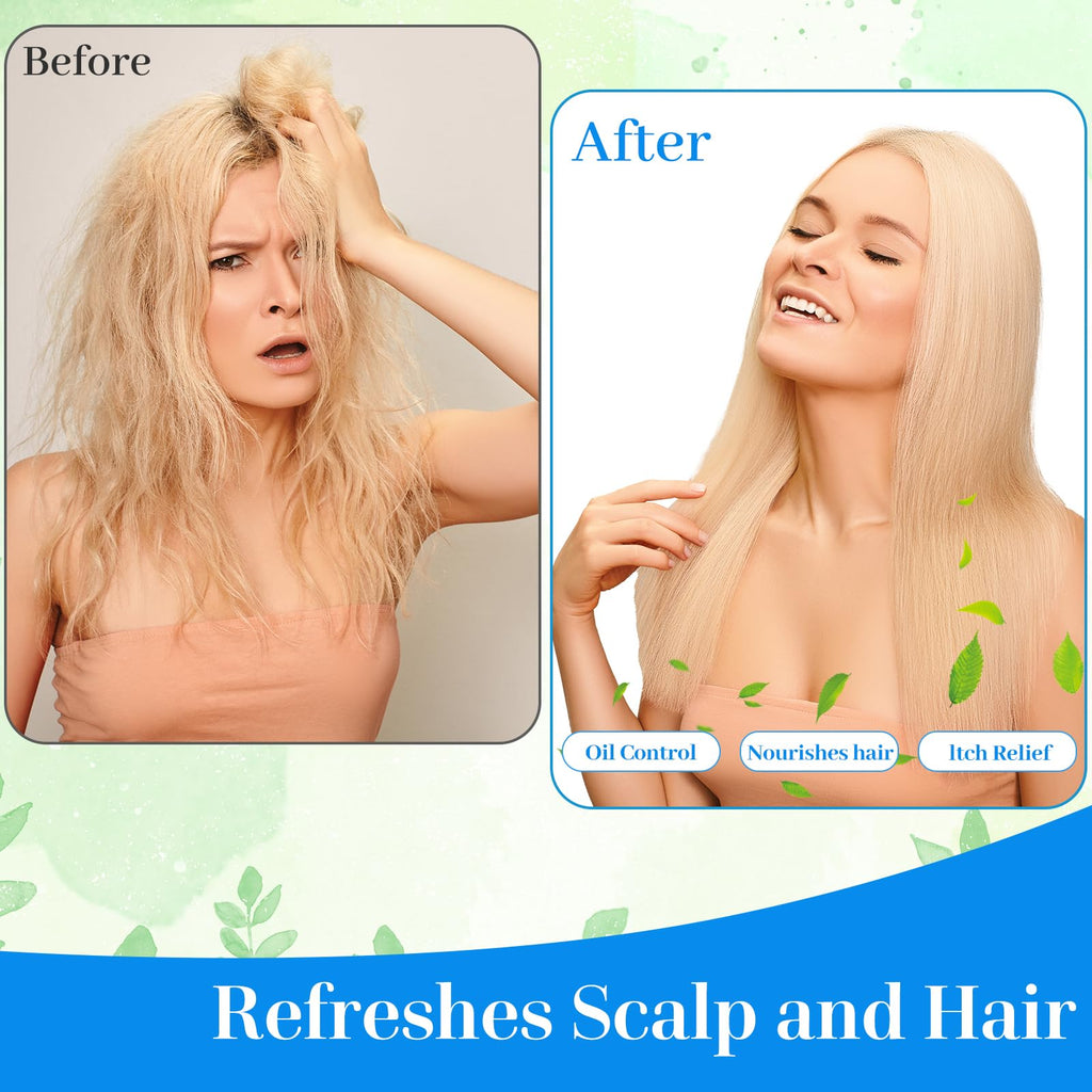 SANPUK Shampoo Cap 12 Pack – No-Rinse, Waterless Hair Care for Adults, Bedridden & Seniors