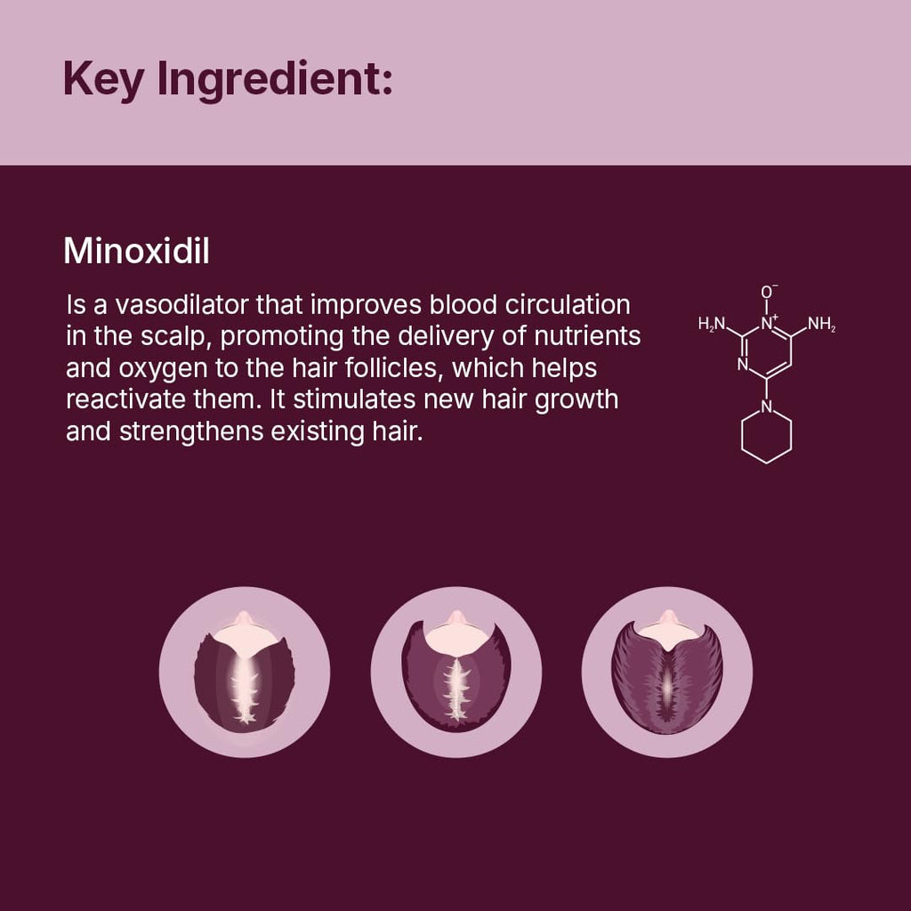 Santo Remedio Women’s Hair Regrowth Treatment – 2% Minoxidil, Fragrance-Free, 1-Month Supply