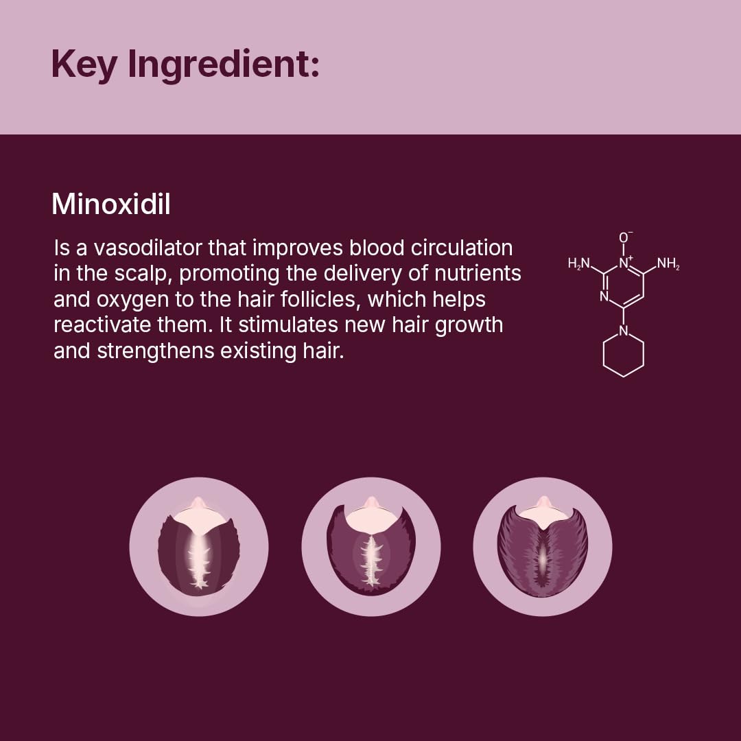 Santo Remedio Women’s Hair Regrowth Treatment – 2% Minoxidil, Fragrance-Free, 1-Month Supply