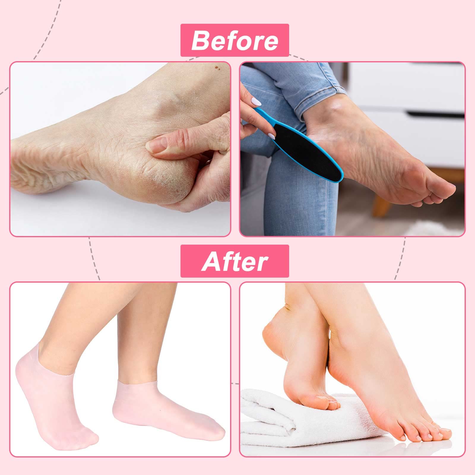 SATINIOR 3 Pairs Silicone Socks – Spa Foot Moisturizing Socks for Dry Feet (Small)