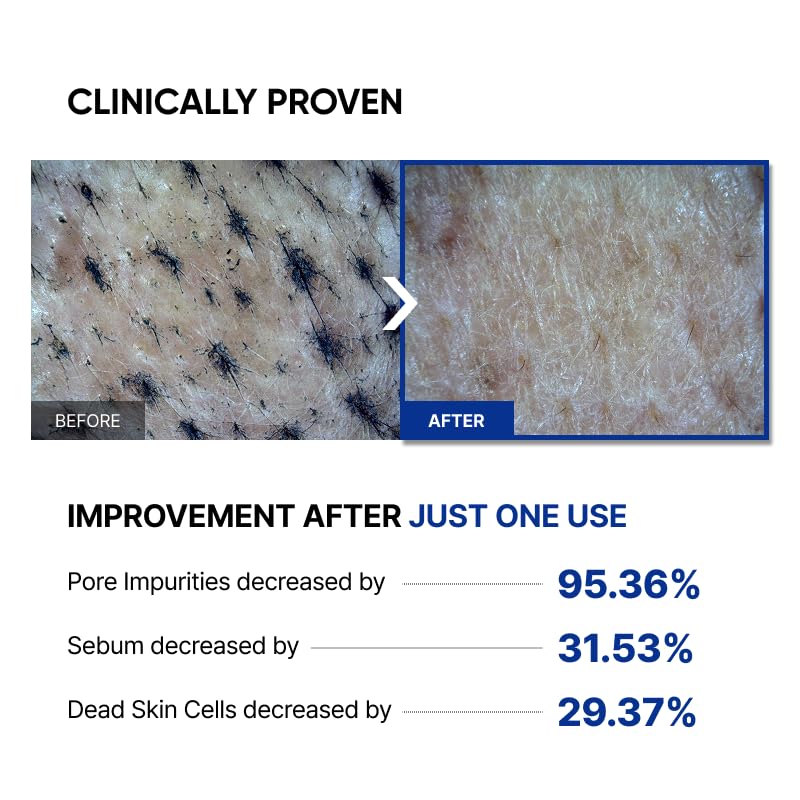 SAYNID Microbiome Renewing Cream Mask – Cream-to-Oil Wash-off Mask for Barrier-Friendly Glass Skin | 100ml