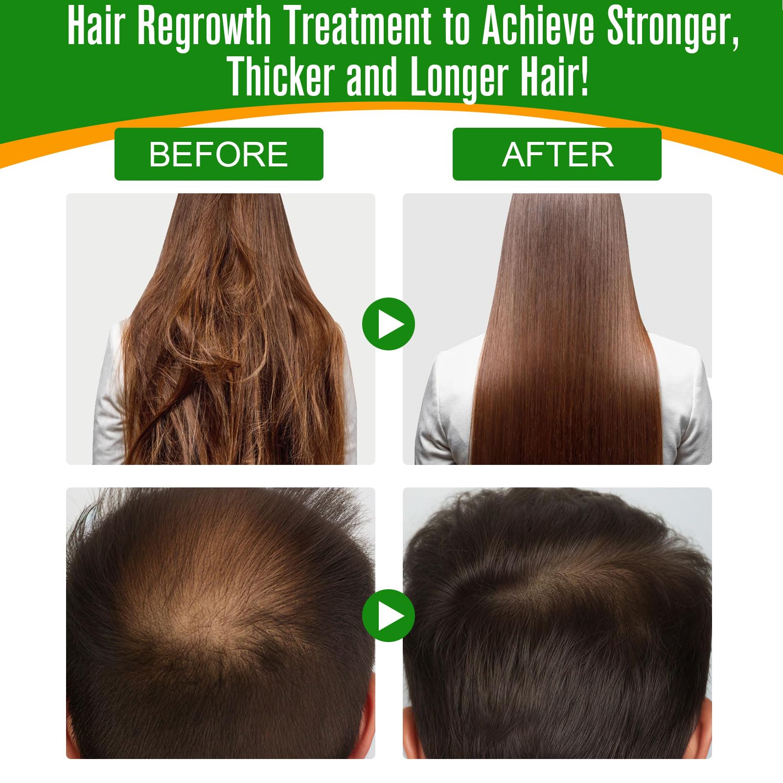 SBHEANGBA Batana Oil for Hair Growth – 60ml, 100% Pure Cold-Pressed Organic Batana Oil
