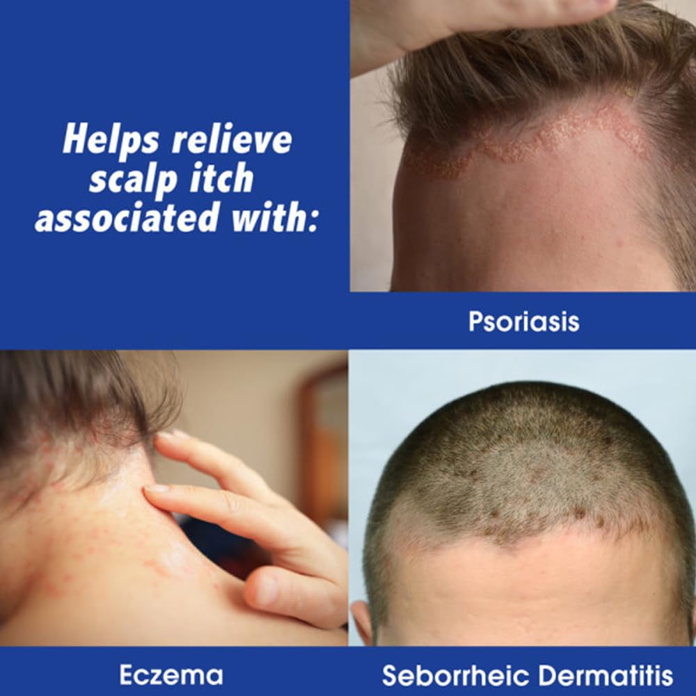 Scalpicin Scalp Itch Relief, 1% Hydrocortisone – Maximum Strength, 6-Pack