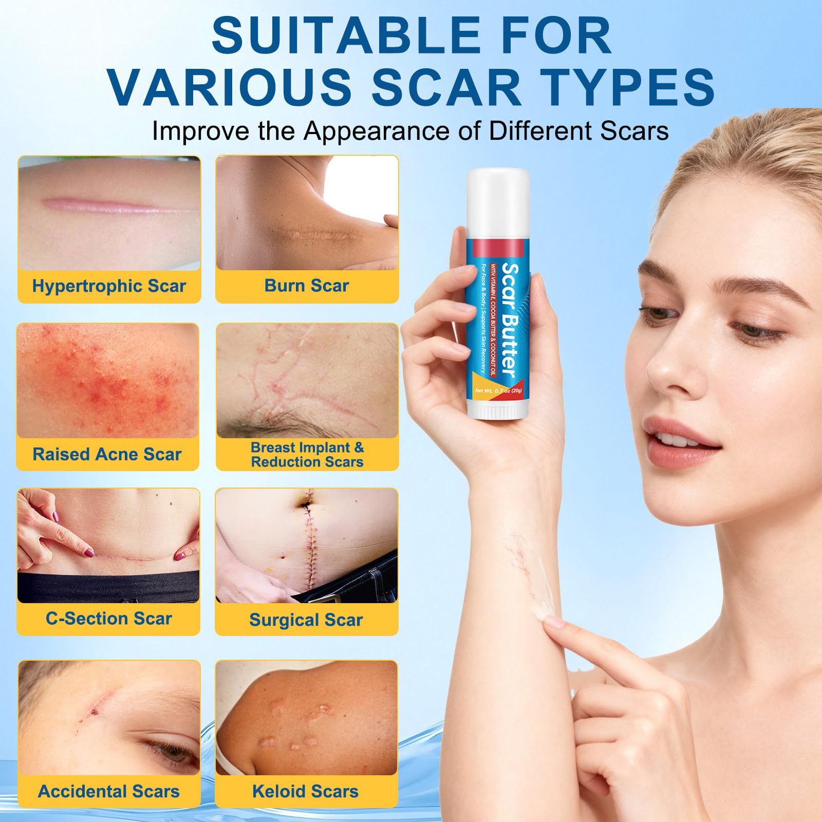 Scar Butter – Vitamin E, Cocoa Butter & Coconut Oil Scar Repair Stick (20g)