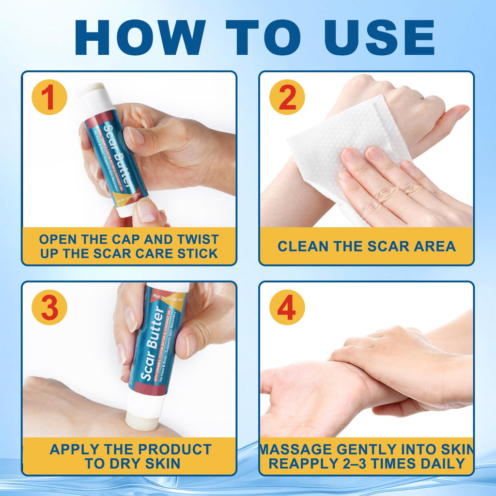 Scar Butter – Vitamin E, Cocoa Butter & Coconut Oil Scar Repair Stick (20g)