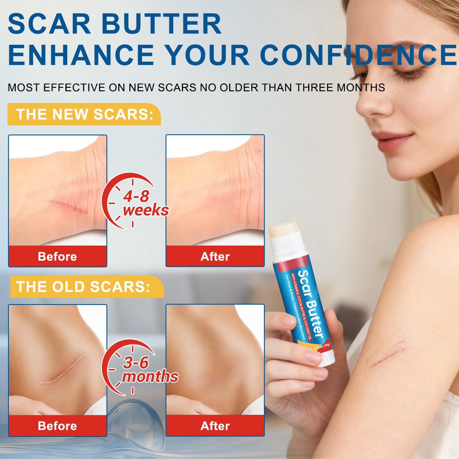 Scar Butter – Vitamin E, Cocoa Butter & Coconut Oil Scar Repair Stick (20g)