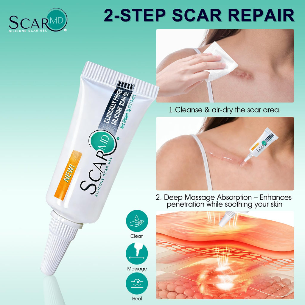 ScarMD Silicone Scar Gel – Roll-On Scar Cream for Surgical, Acne & Keloid Scars