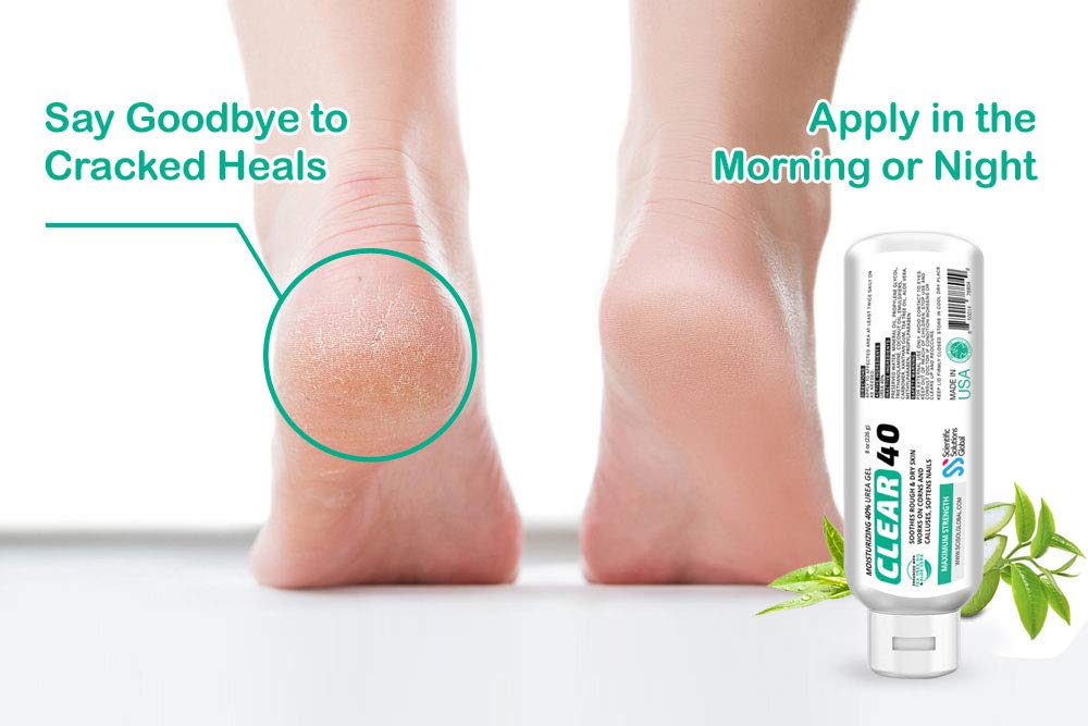 Scientific Solutions Global Clear 40 Urea Gel – 40% Urea, Tea Tree & Coconut Oil, 8 oz
