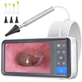ScopeAround Otoscope Ear Camera – 4.5-inch IPS Screen, HD Dual LED, Gyro, 32GB Card