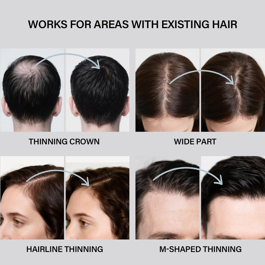 Seaboll Hair Building Fibers – 2-in-1 Hairline & Beard Coverage Kit (Dark Brown)
