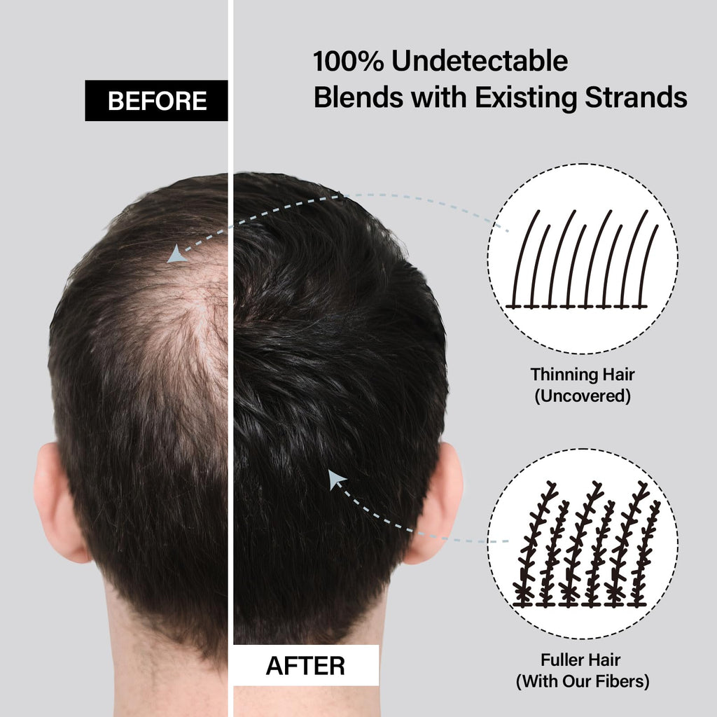 Seaboll Hair Building Fibers – 2-in-1 Hairline & Beard Coverage Kit (Dark Brown)