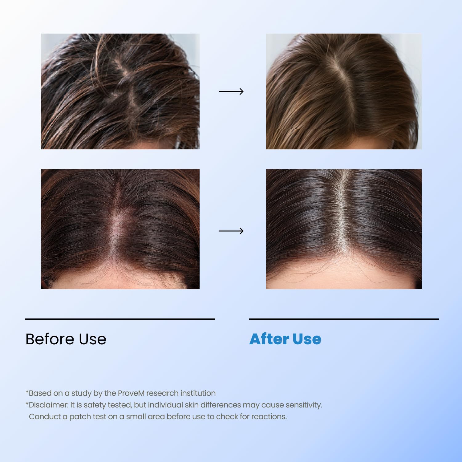 Seapuri Bubble Tonic | Leave-In Scalp Detox Foam for Oily, Itchy Roots