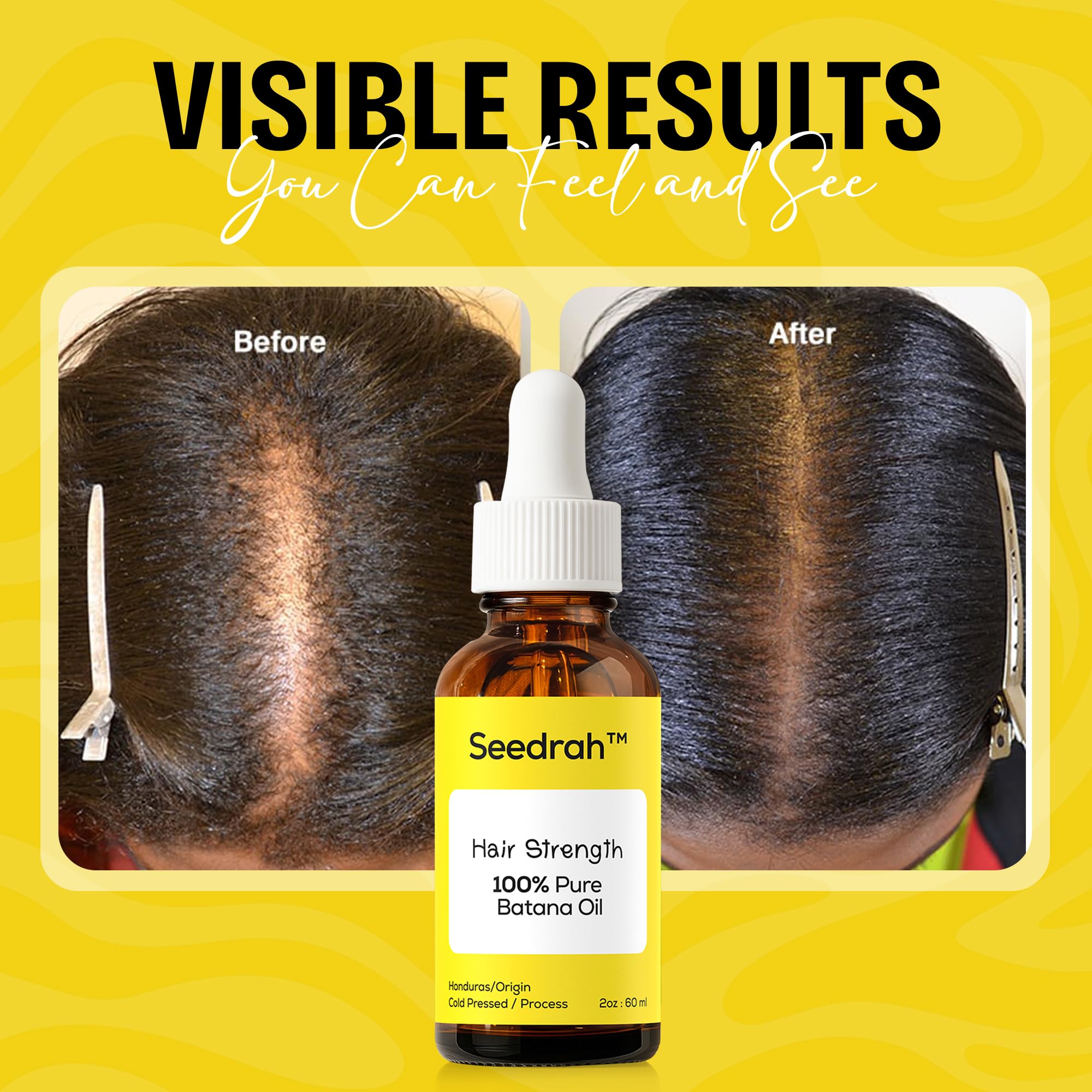 SEEDRAH Batana Oil for Hair Growth – 100% Pure & Natural, Honduras
