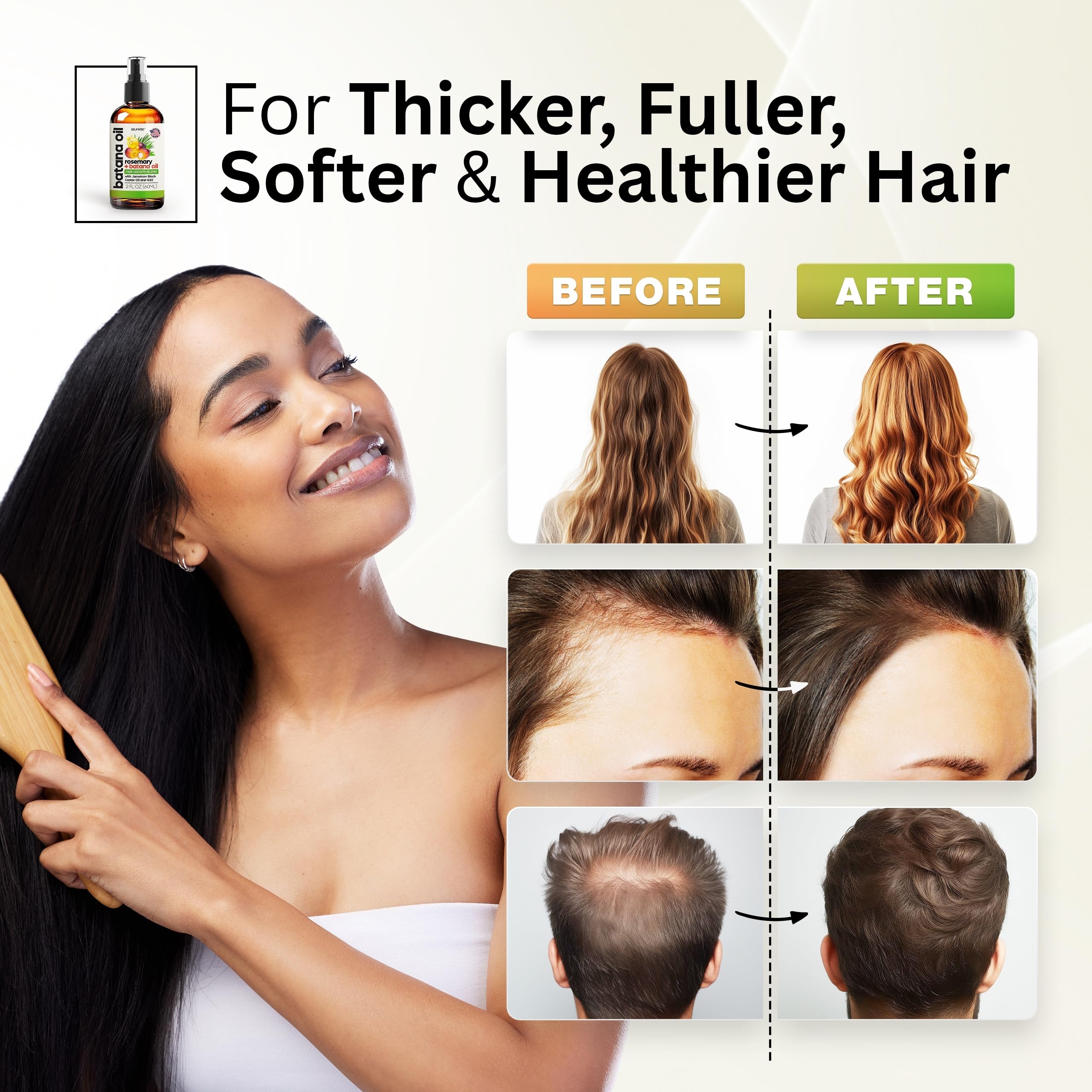 SELFWISE Batana Oil for Hair Growth – Organic Rosemary Castor Blend, 4oz