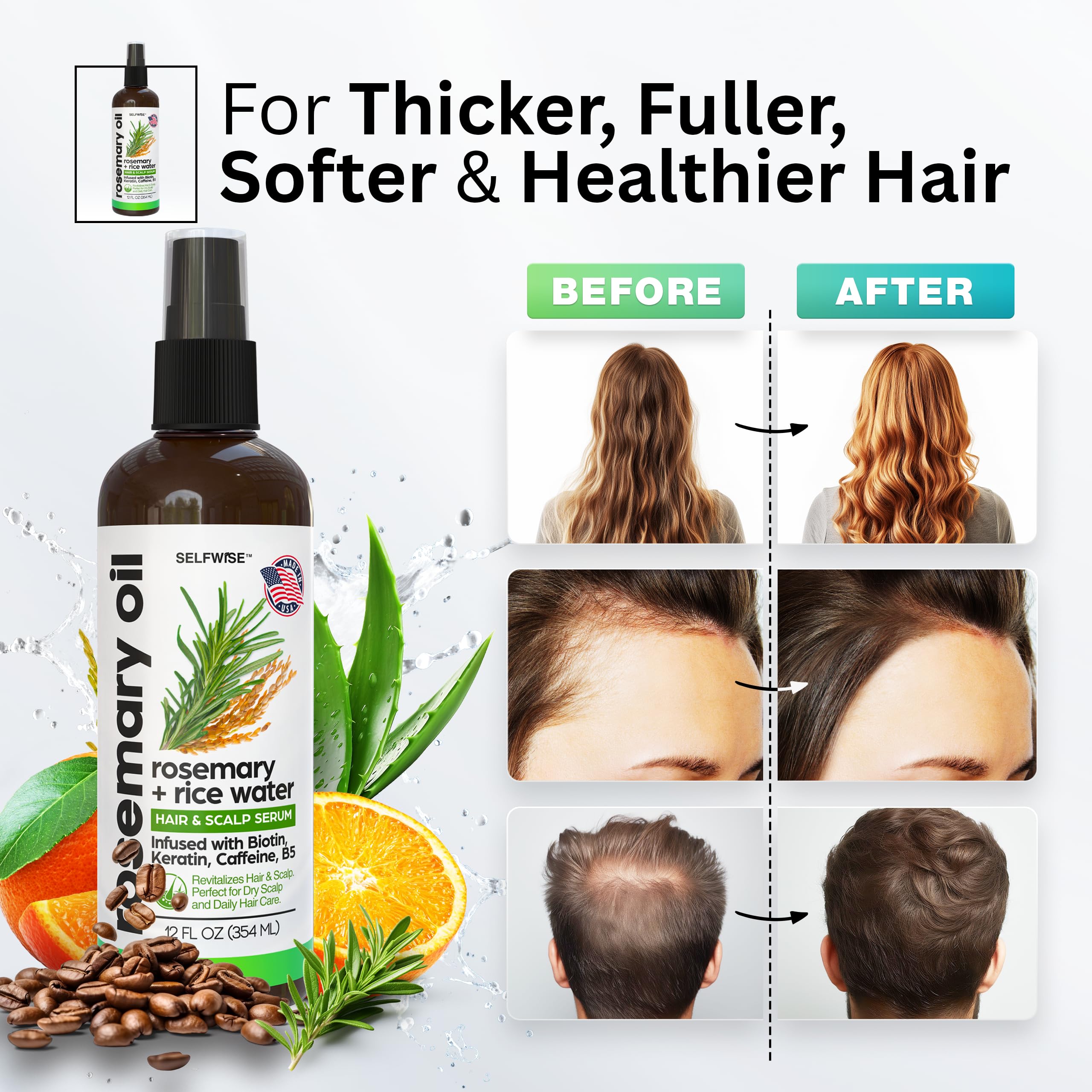 SELFWISE Rosemary Oil & Rice Water Hair Growth Spray – Biotin, Keratin, Caffeine, Vitamin C & B5 | 12oz