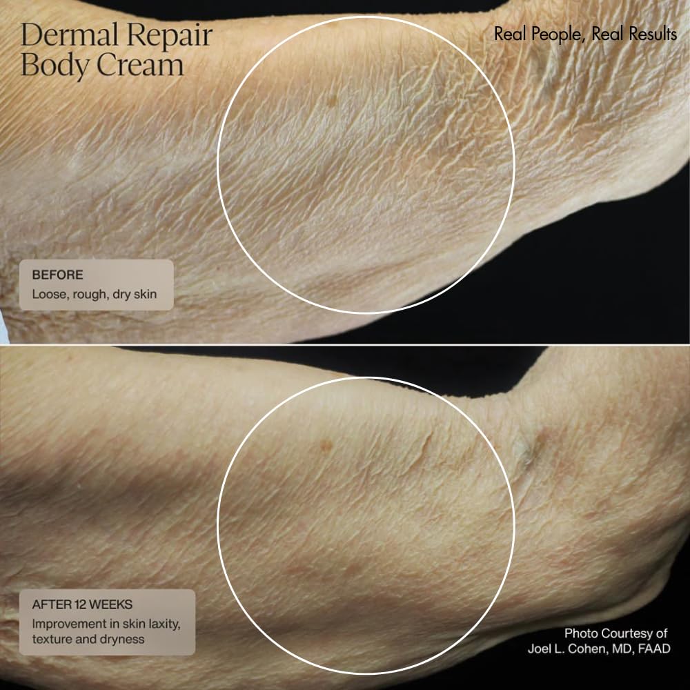 Sente Dermal Repair Body Cream | Restore Skin Barrier, Hydration & Firmer-Looking Skin | 6 oz