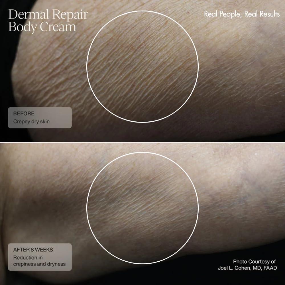 Sente Dermal Repair Body Cream | Restore Skin Barrier, Hydration & Firmer-Looking Skin | 6 oz