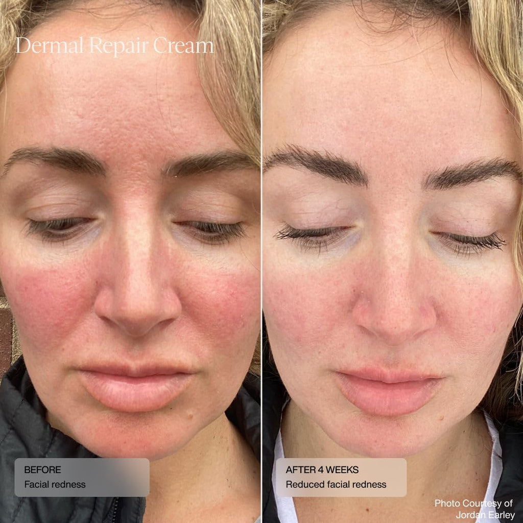 Sente Dermal Repair Facial Cream | Hydration & Soothing for Rosacea & Sensitive Skin