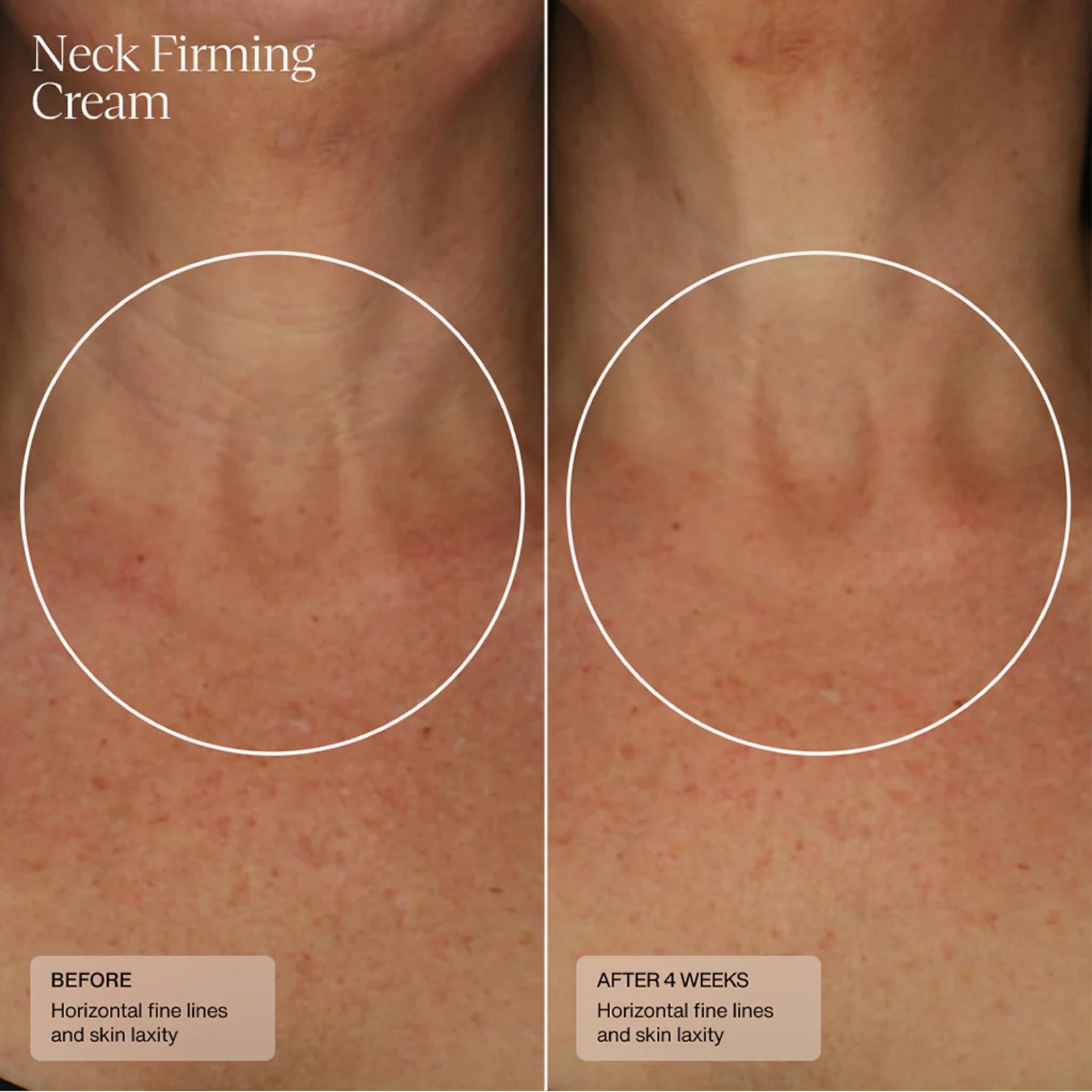 Sente Firming Neck Cream for Crepey Skin & Vertical Lines | Lifts, Firms & Smooths Neck & Décolleté | HSA, Caffeine, Vitamin C | 1.7 oz
