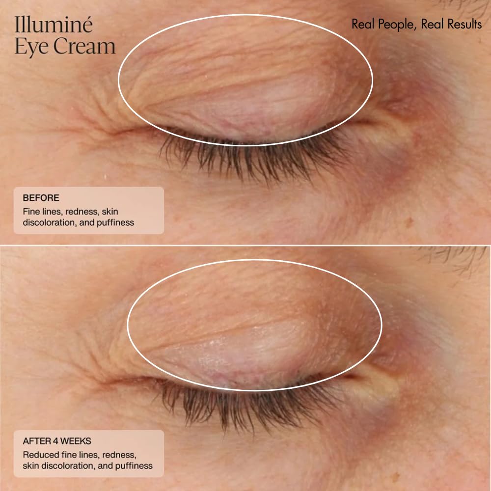 Senté Illumine Eye Cream | Diminish Dark Circles, Redness & Puffiness | HSA, Niacinamide & Peptides | 0.5 oz