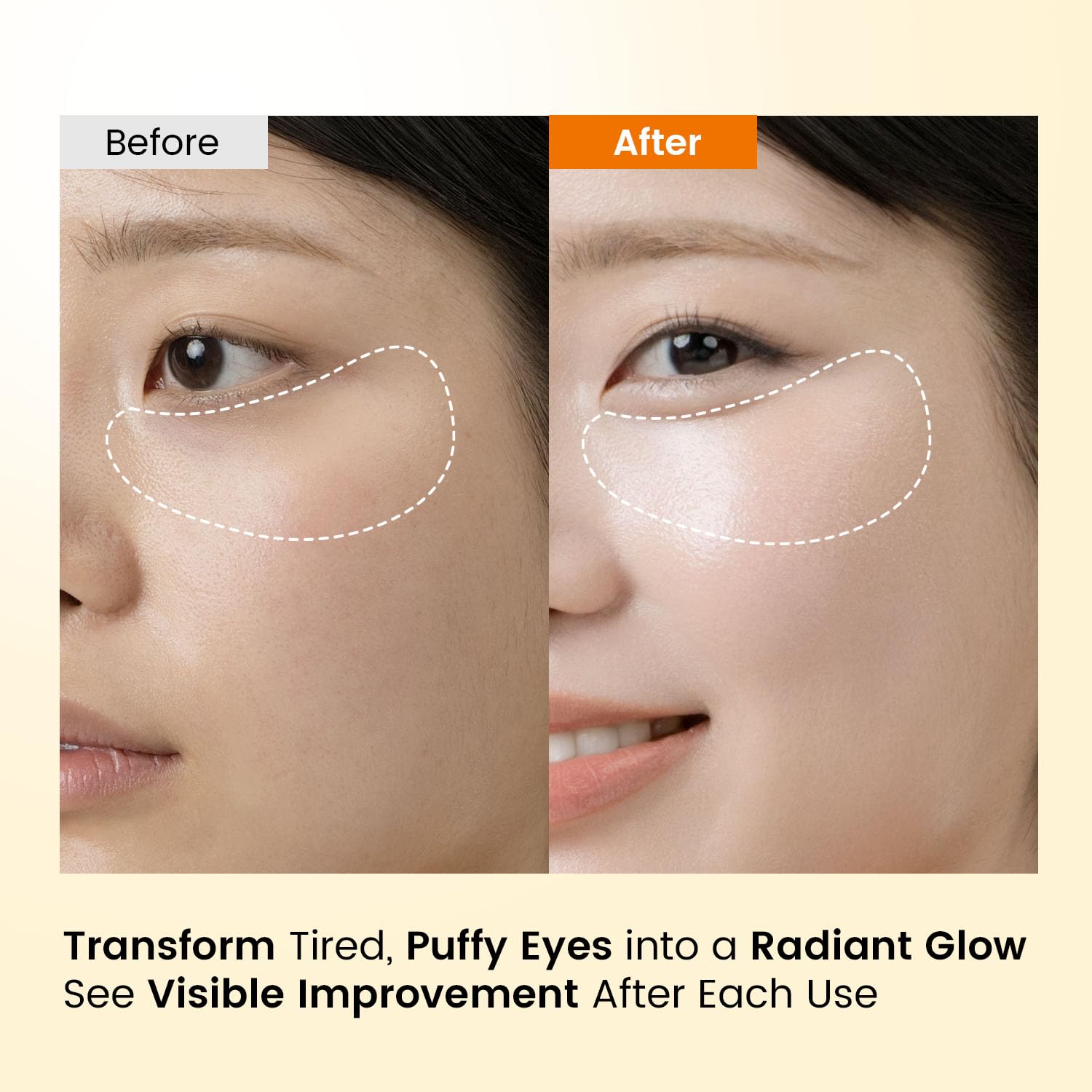 SEONGLOW Caffeine Under Eye Patches – 30 Pairs | Brighten & Hydrate
