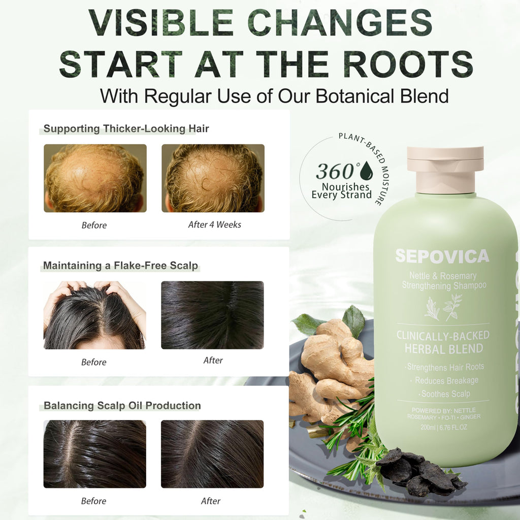 SEPOVICA Nettle & Rosemary Shampoo – Hair Growth, Thinning Hair & Oil Control | Volumizing, Paraben Free (6.76 fl oz)